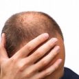 If you’re losing your hair or have thinning hair, it can devastate your self-esteem. But there are steps you can take to combat the emotional impact of hair loss. Hair […]