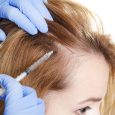Platelet-rich plasma (PRP) therapy is a successful treatment for various dermatologic conditions, including male and female pattern hair loss as well as scars. Those are the findings from a so-called […]