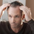 Hair restoration in San Diego, CA , has come a long way over the years. From the only option being to wear a toupee or simply accept baldness to advanced […]