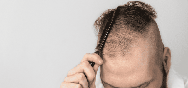 This post is authored by top hair stylist Matthew Curtis, who explains the best ways men can style thinning hair. THE PROBLEM: THINNING HAIR DO KEEP HAIR SHORT AND TEXTURED […]