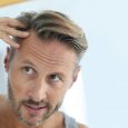 A number of products are available that claim to encourage hair restoration in 2019. Effectiveness, however, ranges a great deal and varies by individual. Confusing matters even more, ingredients commonly […]